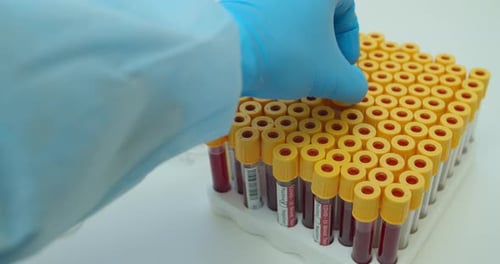 Gloved Hand Removes Positive Covid Blood Test Vial