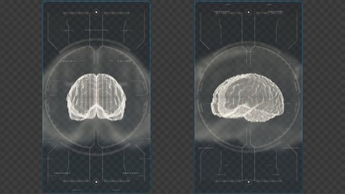 Superposición de escáner de cerebro humano Transparency