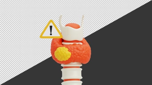3D Animation of Thyroid Nodules and Cancer | Alpha Channel