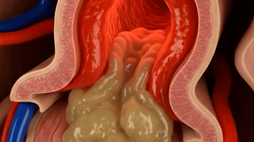 3D Animated Cross-Section of Human Esophagus with Bolus Movement