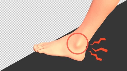 3D Ankle pain | Alpha Channel