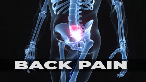 Human Skeleton Medical Scan with Animated Pain Points