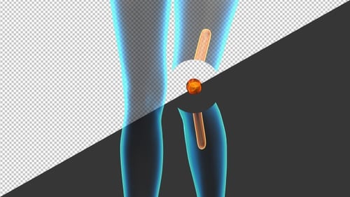 3D Medical Visualization of Human Knee Joint Pain | Alpha Channel