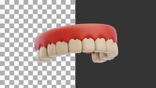3D Animation of Periodontitis and gum recession in dynamics | Alpha Channel