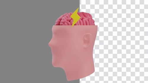 3D Animation of Stroke Brain Impact | Alpha Channel