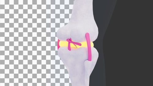 3D Animation of Knee Pain | Alpha Channel