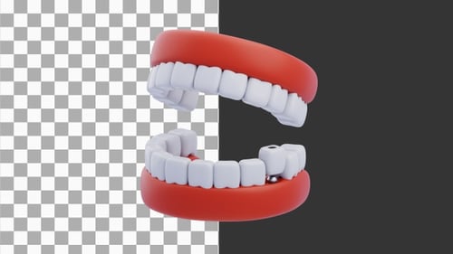 3D Animation of Dental Implant | Alpha Channel