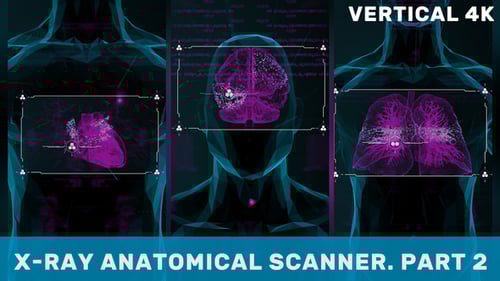 Escáner anatómico vertical de rayos X. Parte 2