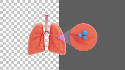 Schéma 3D du cancer du poumon | Alpha Channel