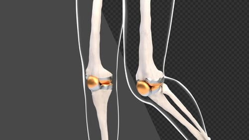 3D Animation of Knee Surgery | Alpha Channel