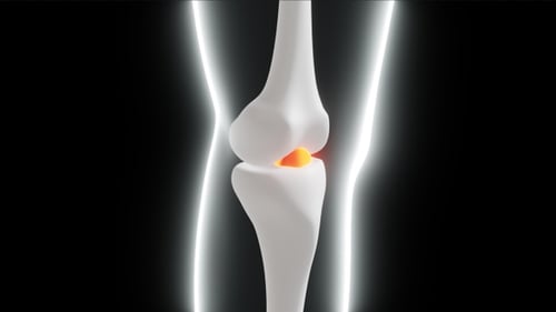 3D Human Knee Joint Flexing with Inflamed Area Animation