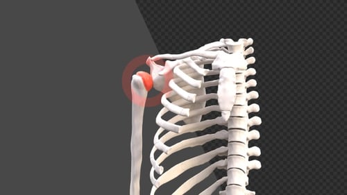3D Animation of Shoulder Inflammation and Joint Pain | Alpha Channel