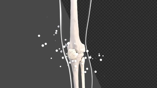 3D Healing of Leg and Knee Bones | Alpha Channel