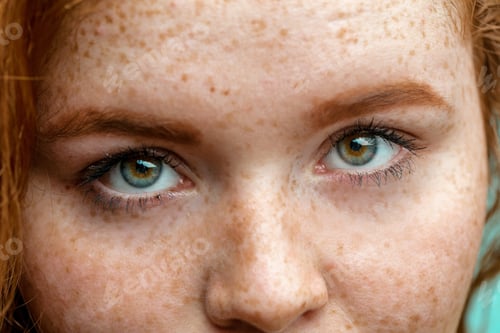 Preview: Close Up Face Of Young Red Ginger Freckled Woman With Healthy Freckled Skin, Skin Care Or Skin