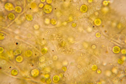 Preview: Rotten Leaves At The Microscope, Details And Shapes