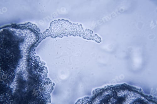 Preview: Mold At The Microscope