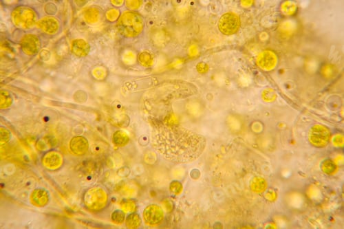 Preview: Rotten Leaves At The Microscope, Details And Shapes