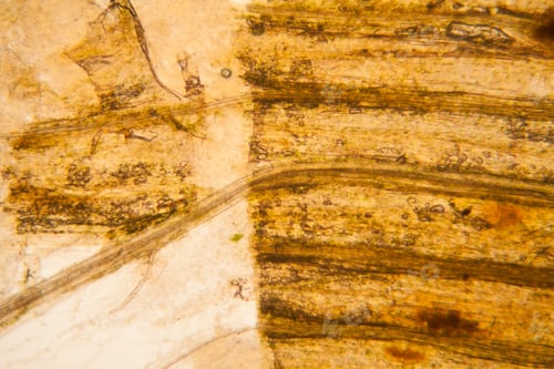 Preview: Microscopic View And Details Of Rotten Tulip Stem