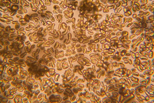 Preview: Mold At The Microscope