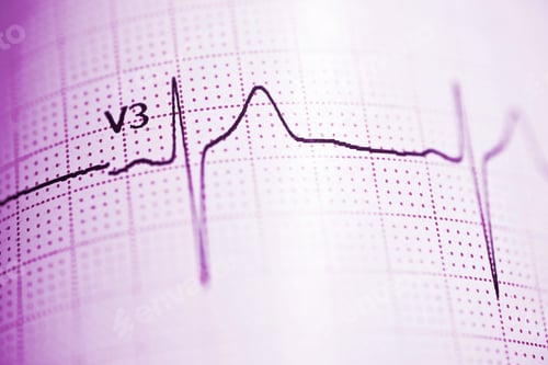 Preview: Close Up Of An Electrocardiogram In Paper Form.