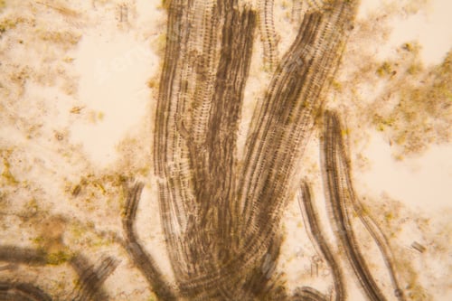 Preview: Microscopic View And Details Of Rotten Tulip Stem