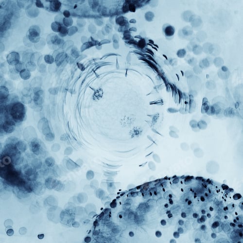 Preview: Abstract Underwater Games With Jelly Balls, Bubbles And Light