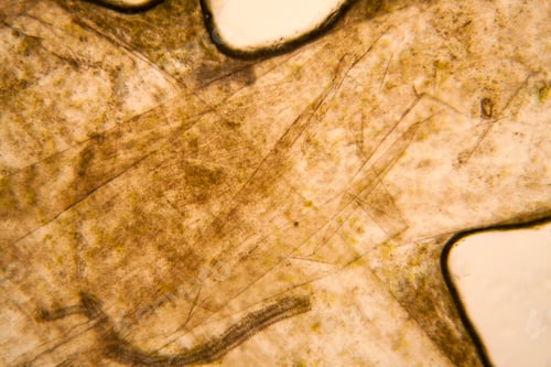 Preview: Microscopic View And Details Of Rotten Tulip Stem