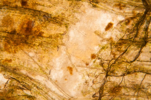 Preview: Microscopic View And Details Of Rotten Tulip Stem