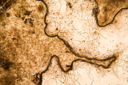 Vista previa: Mold At The Microscope