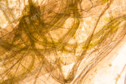 Preview: Microscopic View And Details Of Rotten Tulip Stem