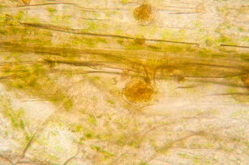 Preview: Microscopic View And Details Of Rotten Tulip Stem