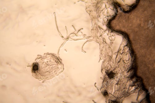 Preview: Mold At The Microscope