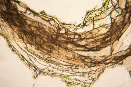 Preview: Microscopic View And Details Of Rotten Tulip Stem