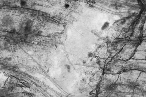 Preview: Microscopic View And Details Of Rotten Tulip Stem