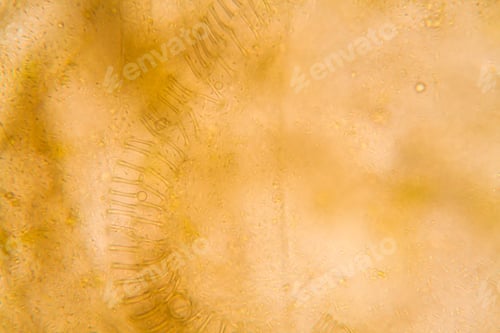 Preview: Microscopic View And Details Of Rotten Tulip Stem