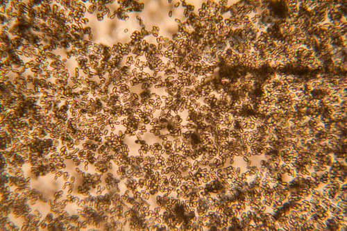 Preview: Mold At The Microscope