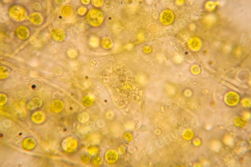 Preview: Rotten Leaves At The Microscope, Details And Shapes