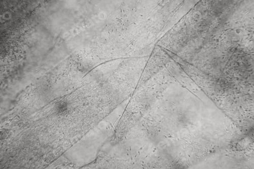 Preview: Microscopic View And Details Of Rotten Tulip Stem
