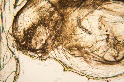 Preview: Microscopic View And Details Of Rotten Tulip Stem