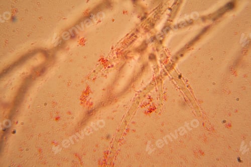 Preview: Mold At The Microscope