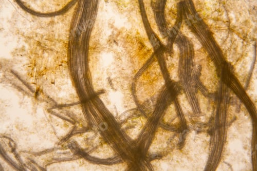 Preview: Microscopic View And Details Of Rotten Tulip Stem