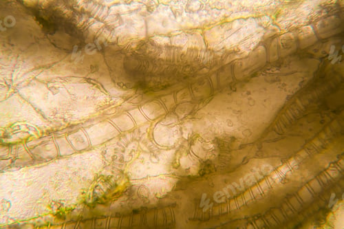 Preview: Microscopic View And Details Of Rotten Tulip Stem