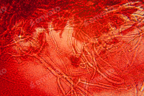 Preview: Mold At The Microscope