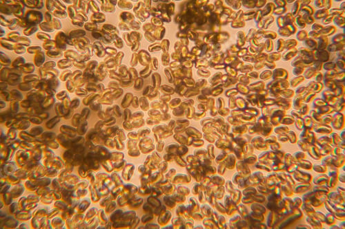 Preview: Mold At The Microscope