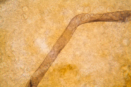 Preview: Microscopic View And Details Of Rotten Tulip Stem
