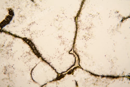 Preview: Microscopic View And Details Of Rotten Tulip Stem