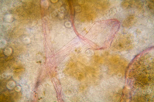 Preview: Rotten Leaves At The Microscope, Details And Shapes