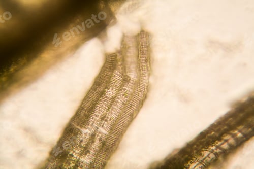 Preview: Microscopic View And Details Of Rotten Tulip Stem