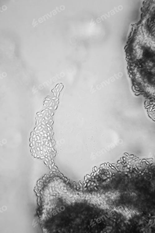 Preview: Mold At The Microscope