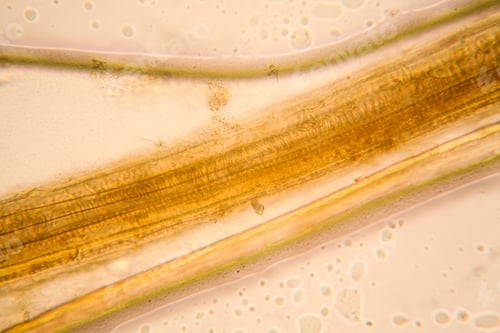 Preview: Microscopic View And Details Of Rotten Tulip Stem